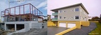 husid-before-after